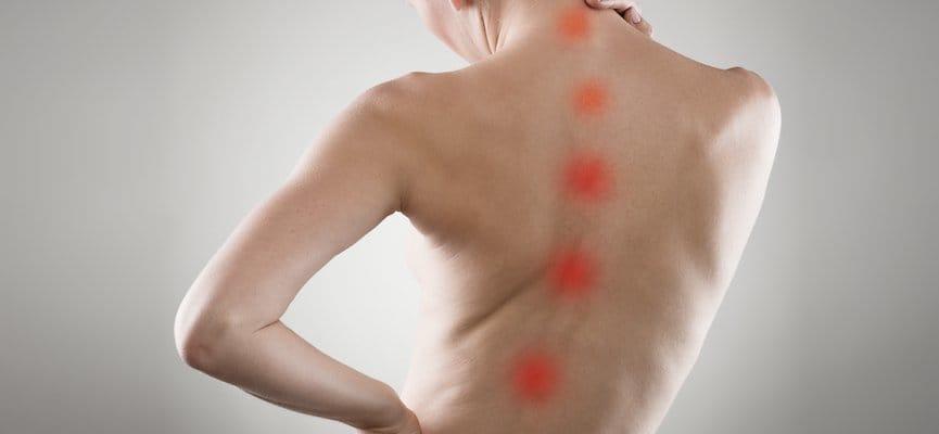 Kenali Gejala Skoliosis pada Anak dan Orang Dewasa