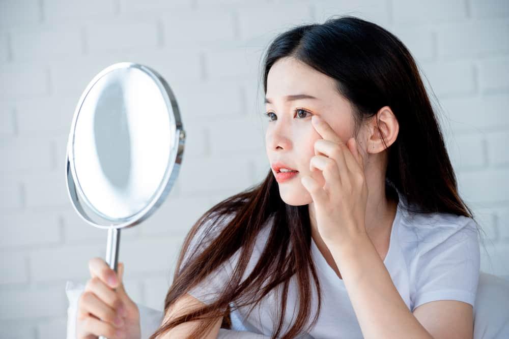 7 Jenis Jerawat dan Ragam Cara Mengatasinya