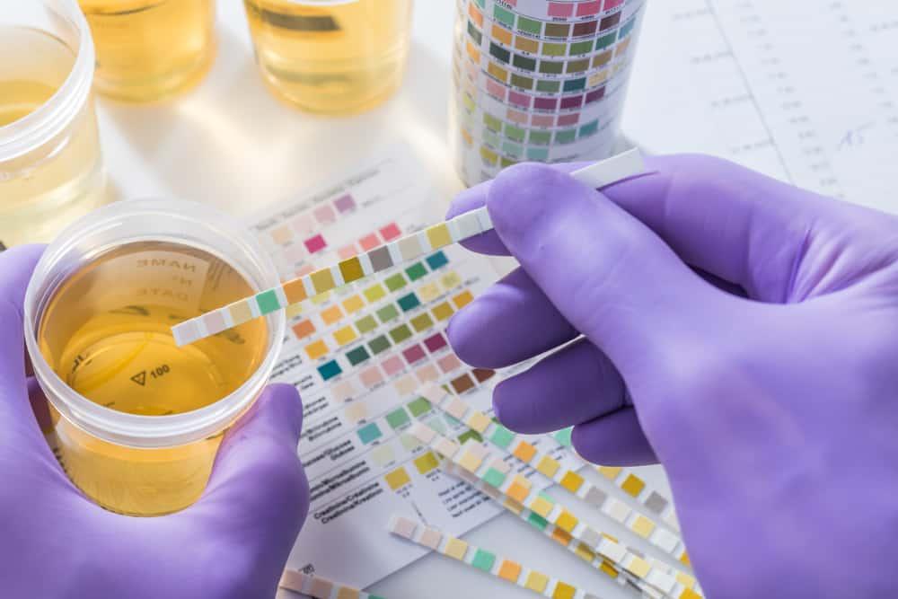 Ciri-Ciri Urine yang Normal Menurut Warna, Bau, dan Jumlahnya