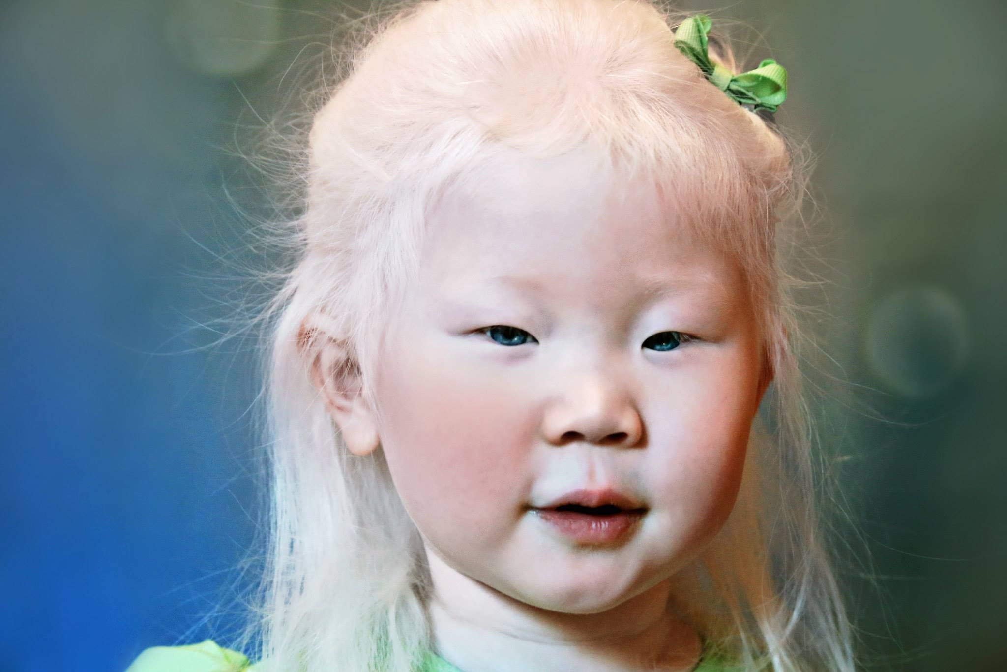 cara-membesarkan-anak-albino