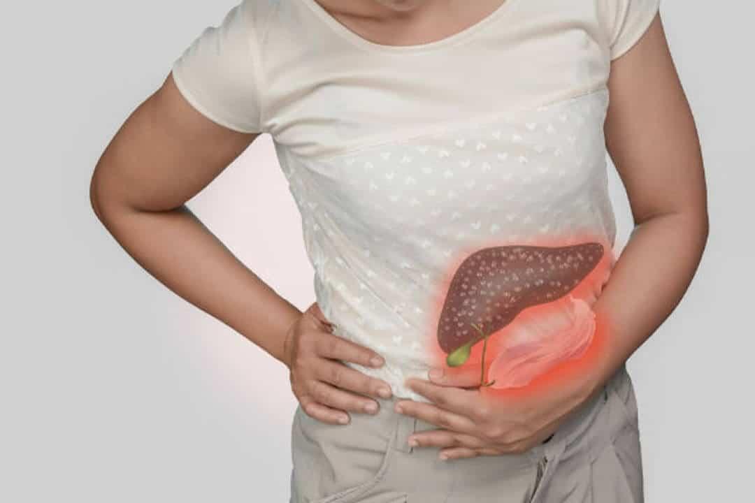 Waspada, Inilah Macam-Macam Gejala Hepatitis A