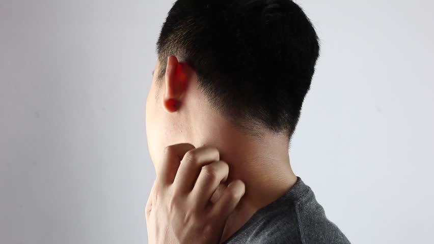 Jenis Penyakit Kulit Menular dan Tidak Menular yang Umum