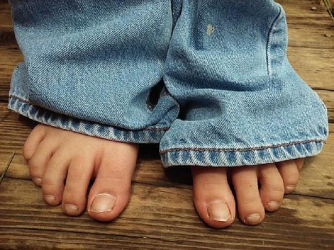 6-jenis-infeksi-jamur-kuku