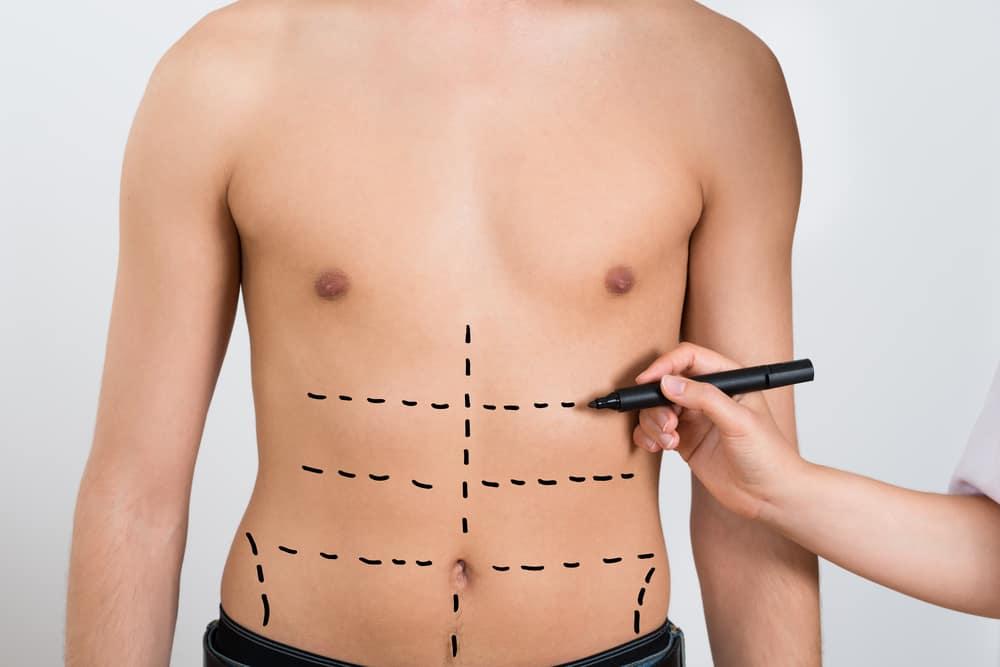 perut-buncit-pada-pria-abdominal-etching