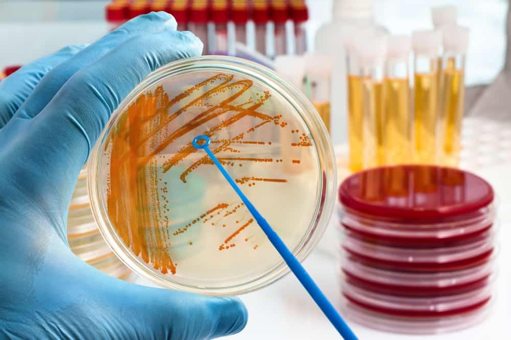 penyakit-infeksi-bakteri-streptococcus