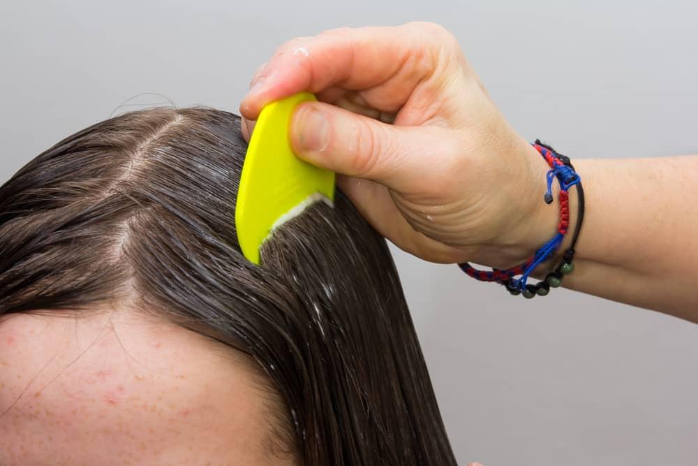 kutu-rambut-tidak-hilang-tanpa-obat