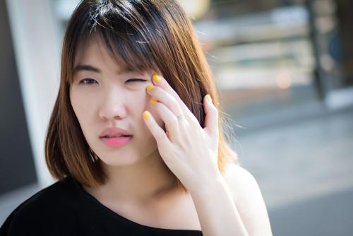 fotokeratitis