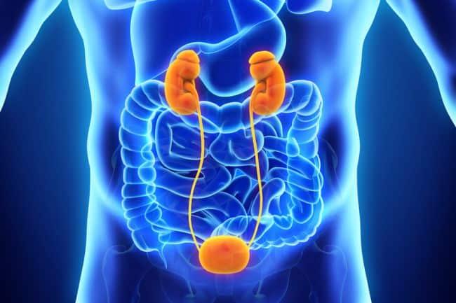 Vesicoureteral Reflux (Refluks Vesikoureter)