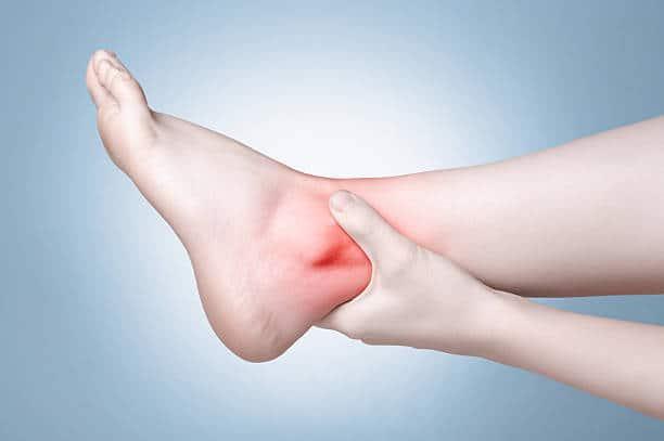 chronic-vein-insufficiency