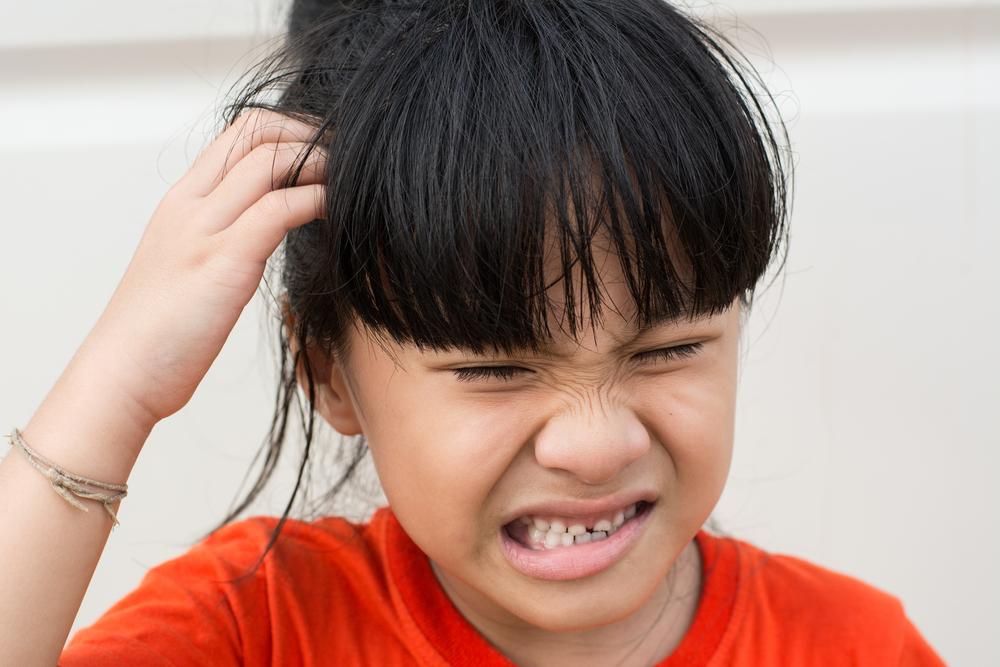 5 Fakta Unik Soal Kutu Rambut, Musuh Kecil yang Menggerayangi Kulit Kepala