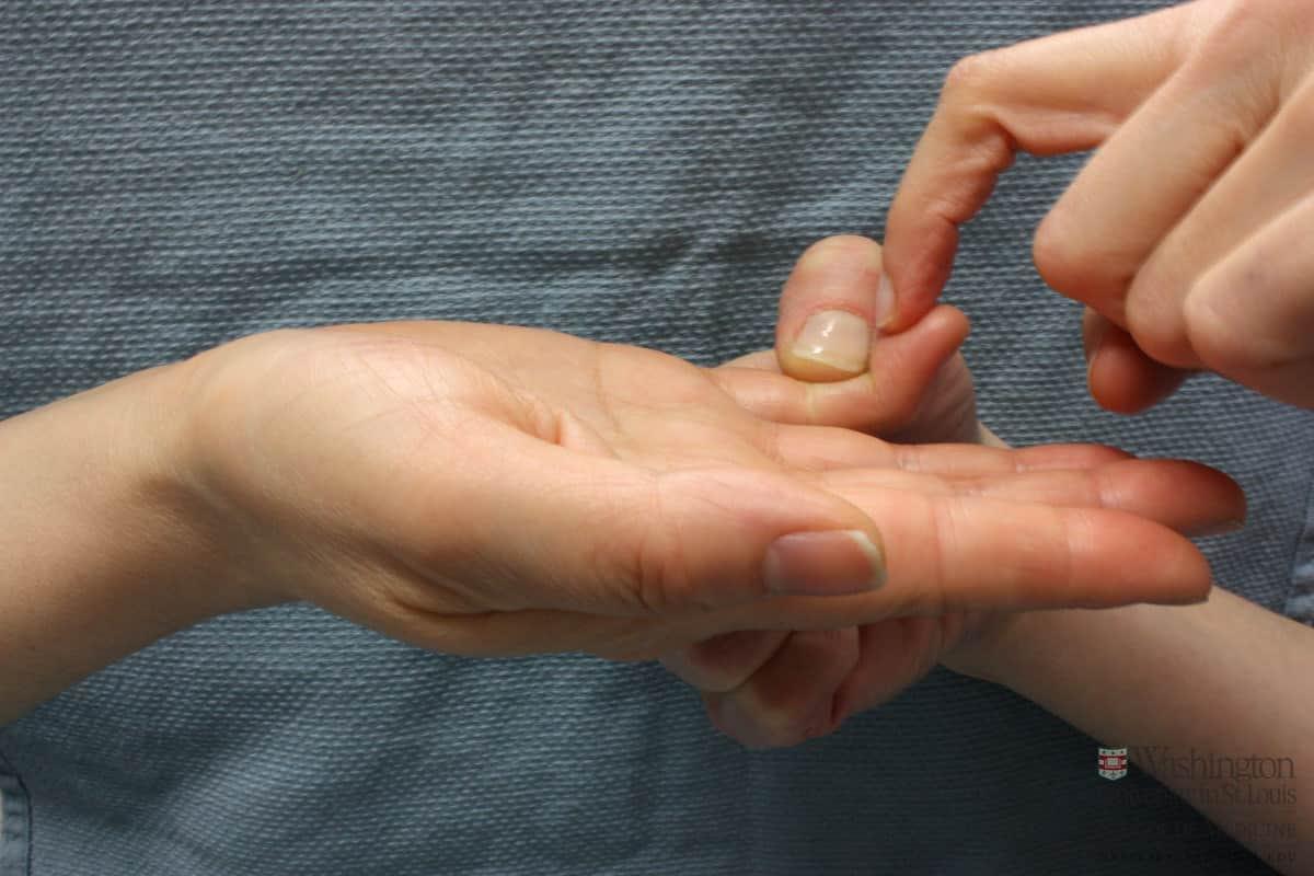 Mallet Finger