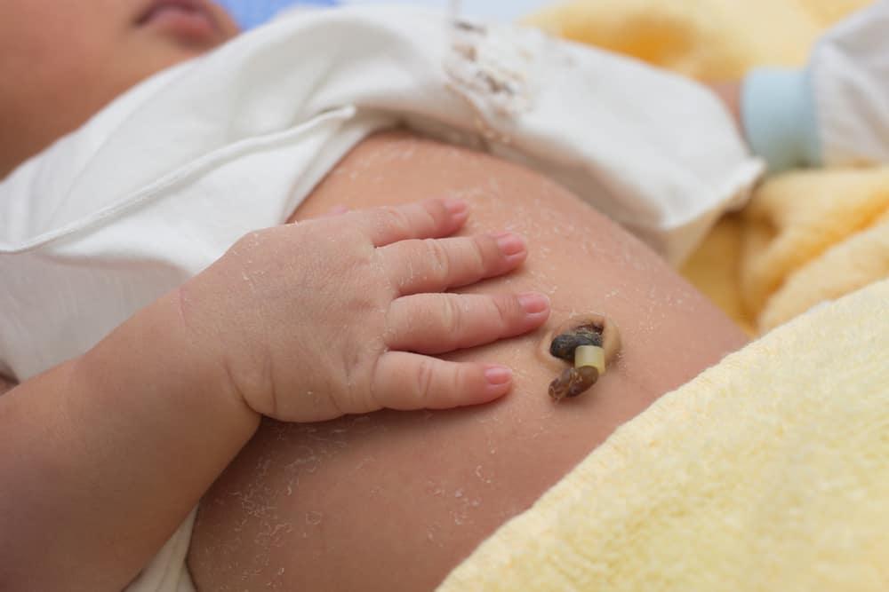 Buat Apa Simpan Tali Pusat Bayi di Bank dan Apakah Benar-benar Perlu?