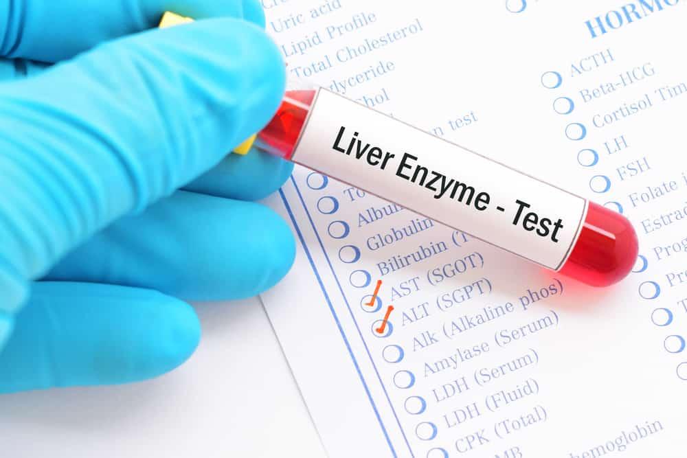 5 Cara Menurunkan Kadar SGOT dan SGPT yang Tinggi