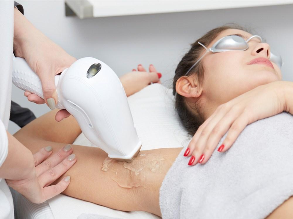 efek-samping-laser-hair-removal
