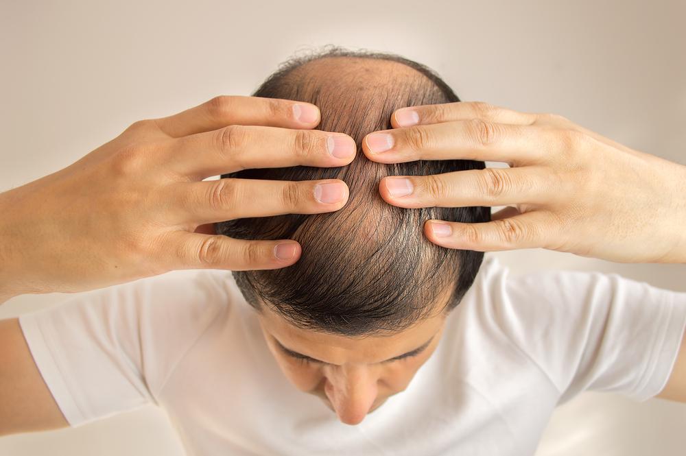 5 Tips Jitu Menumbuhkan Rambut dengan Cepat dan Aman