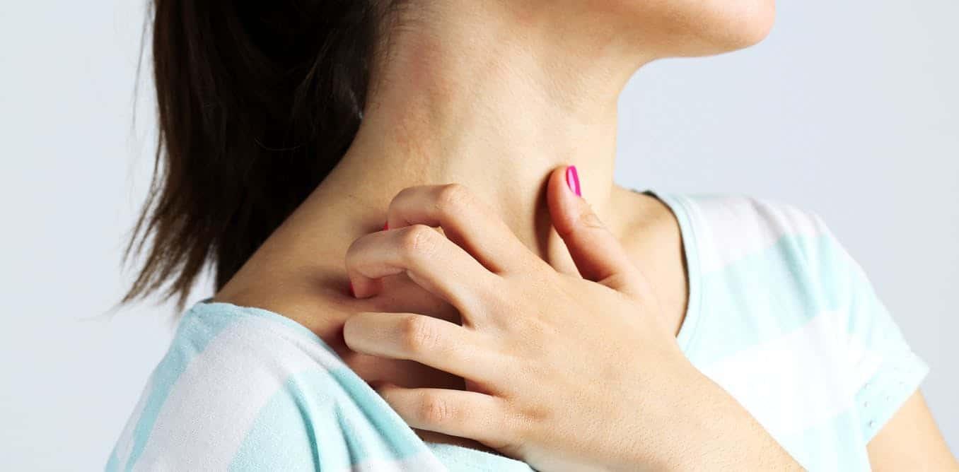 pantangan-untuk-kudis