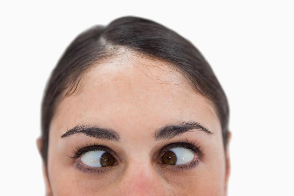 Mengenal Esotropia, Kelainan Mata Juling ke Dalam yang Merusak Penglihatan