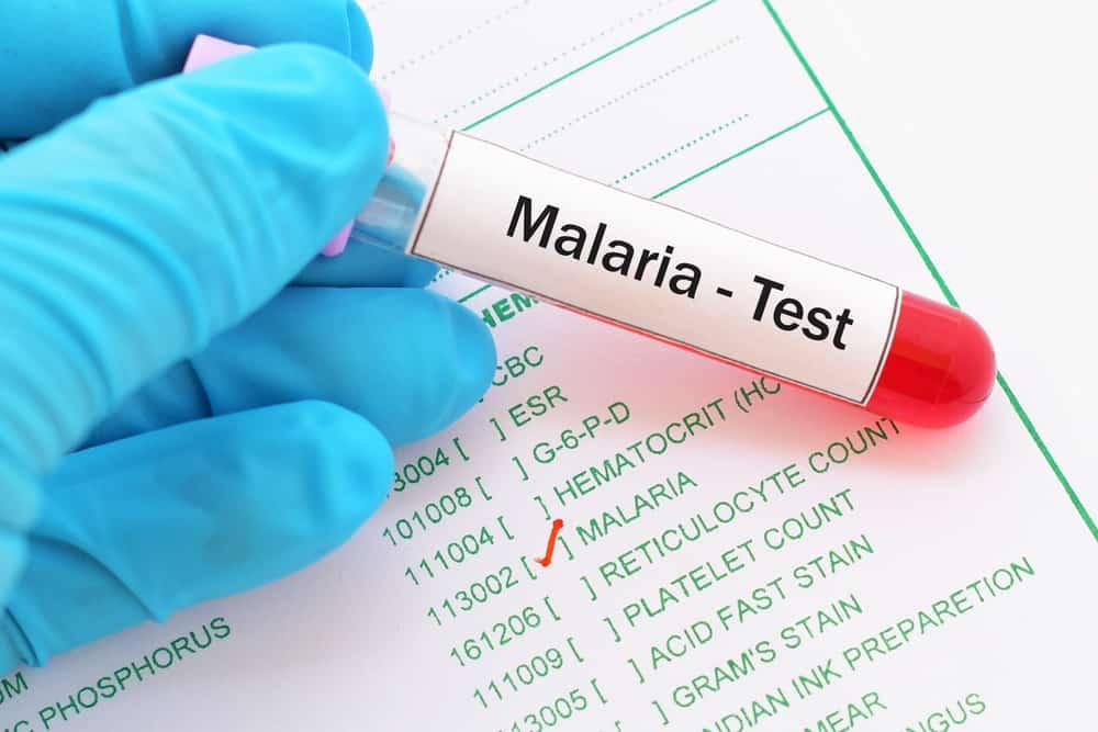 Tanda dan Gejala Penyakit Malaria yang Tidak Boleh Anda Abaikan