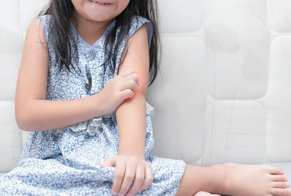 3-jenis-alergi-pada-bayi