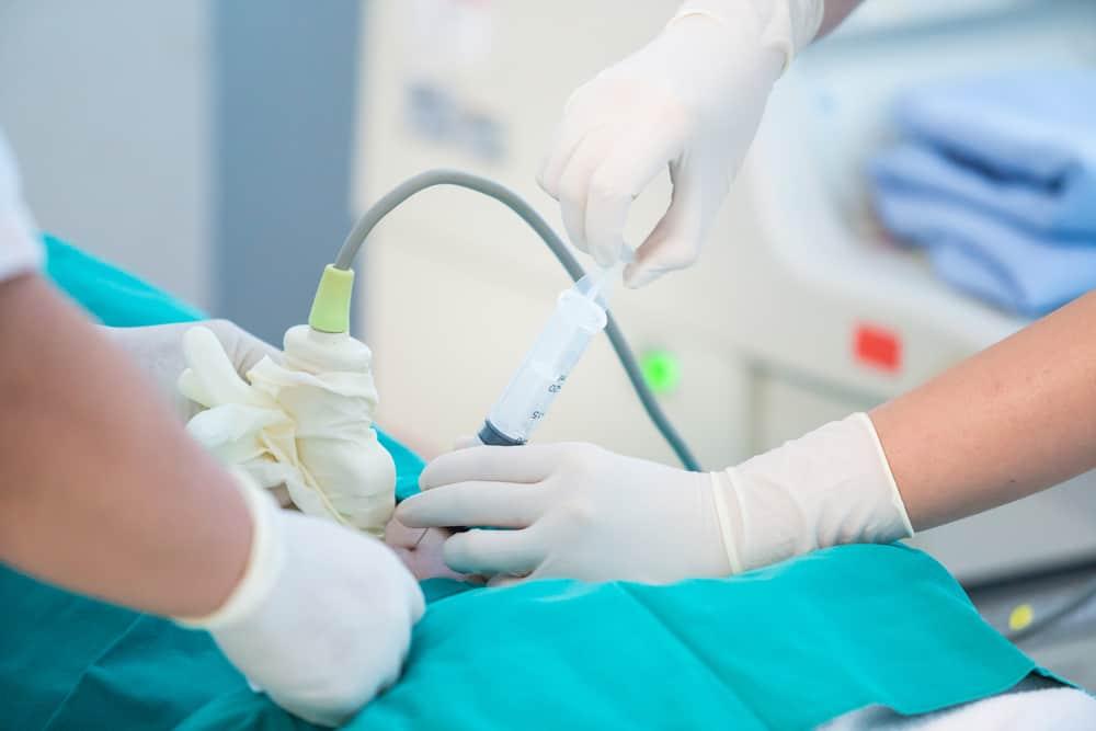 manfaat-tes-amniocentesis-risiko