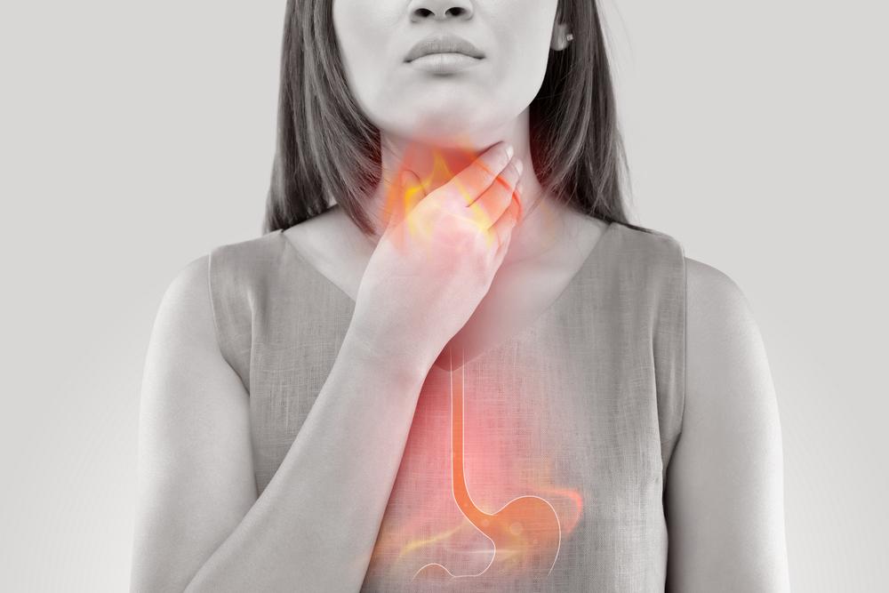 Mengenal Kondisi LPR (Silent Reflux) pada Lambung