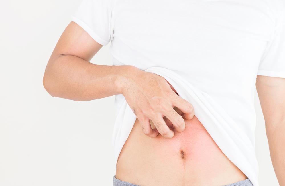 penyebab-dan-cara-mengatasi-perut-gatal-2