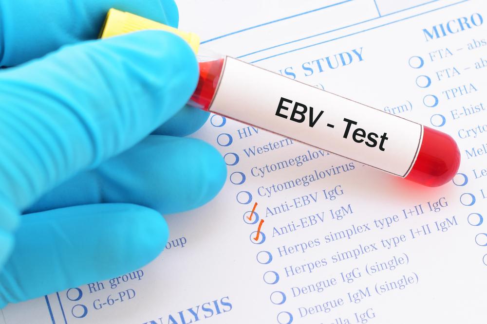 virus-epstein-barr-penyakit-serius