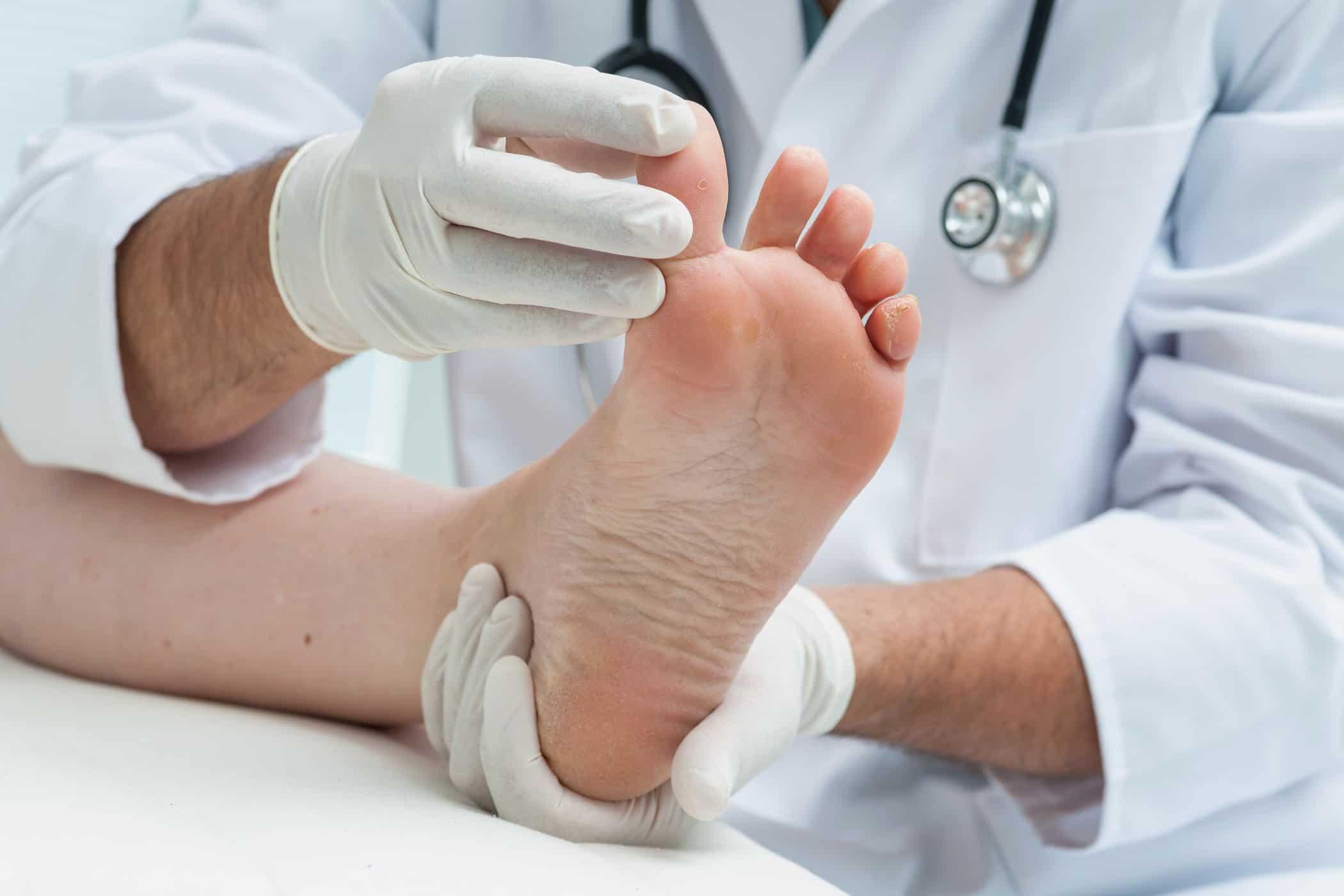 Bisakah Mendeteksi Penyakit dari Kondisi Kaki?