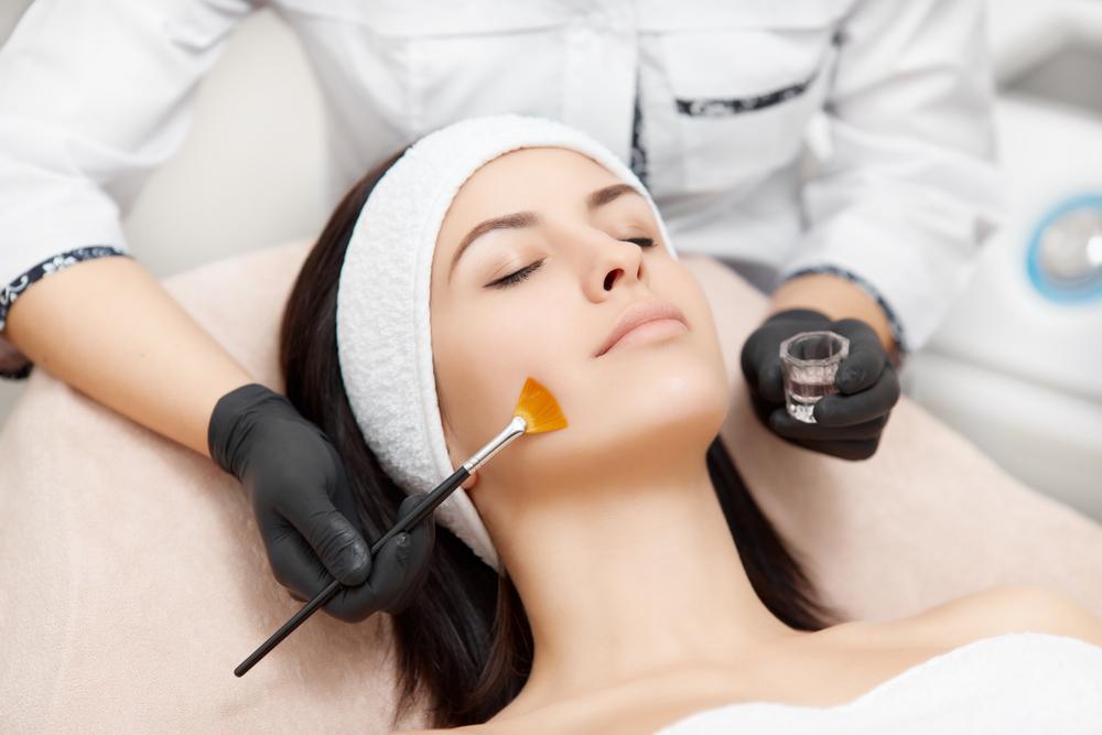 chemical-peeling-sendiri