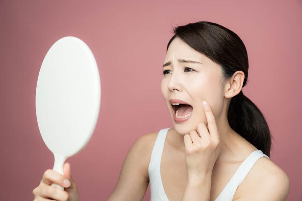 Mungkinkah Kena Depresi Akibat Kulit Jerawatan?