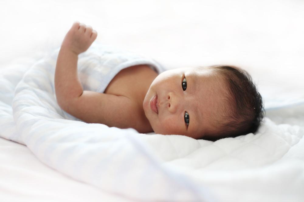 crouzon-syndrome-adalah