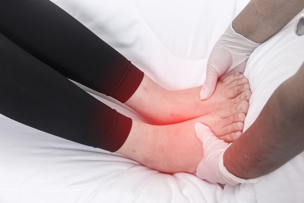 8 Pilihan Obat Alami untuk Atasi Kaki Bengkak