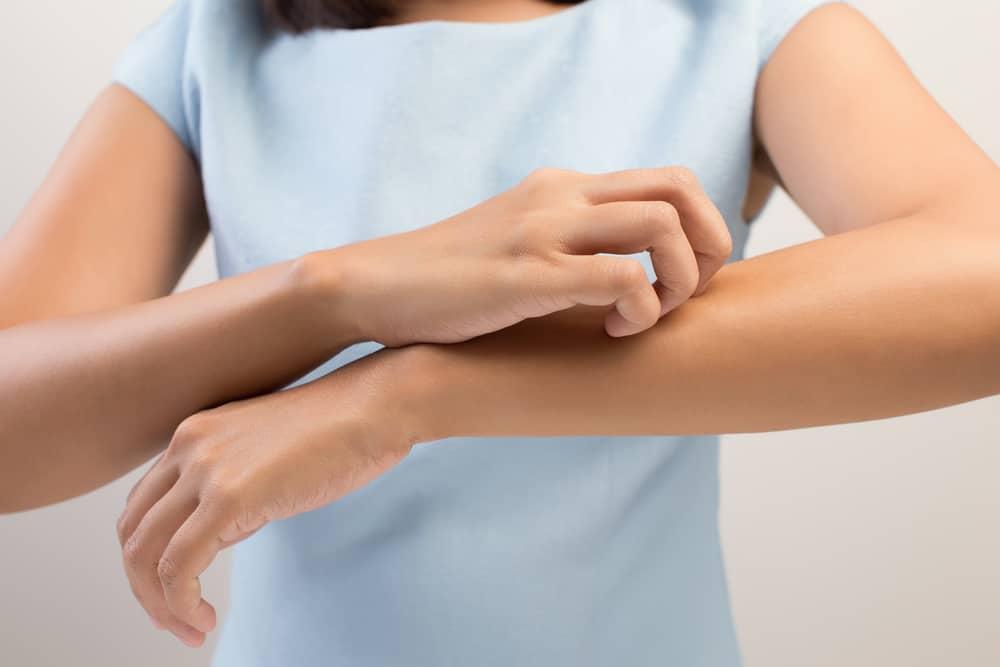 5 Deretan Bahan Alami yang Ampuh Meredakan Gejala Impetigo Pada Anak