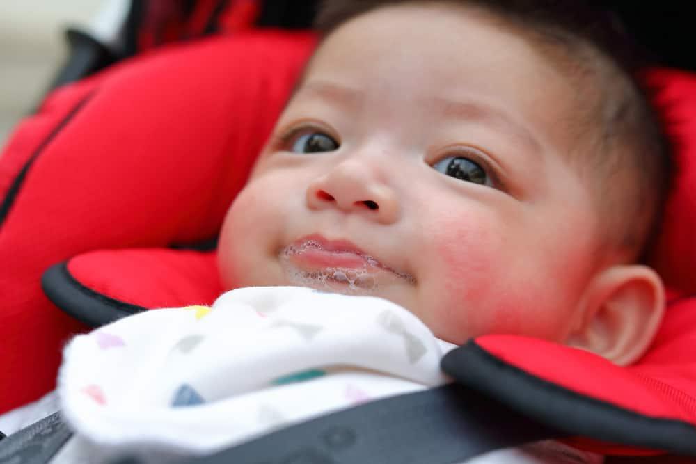 Apa Itu Ruam Air Liur Bayi dan Bagaimana Cara Mencegah dan Mengatasinya?