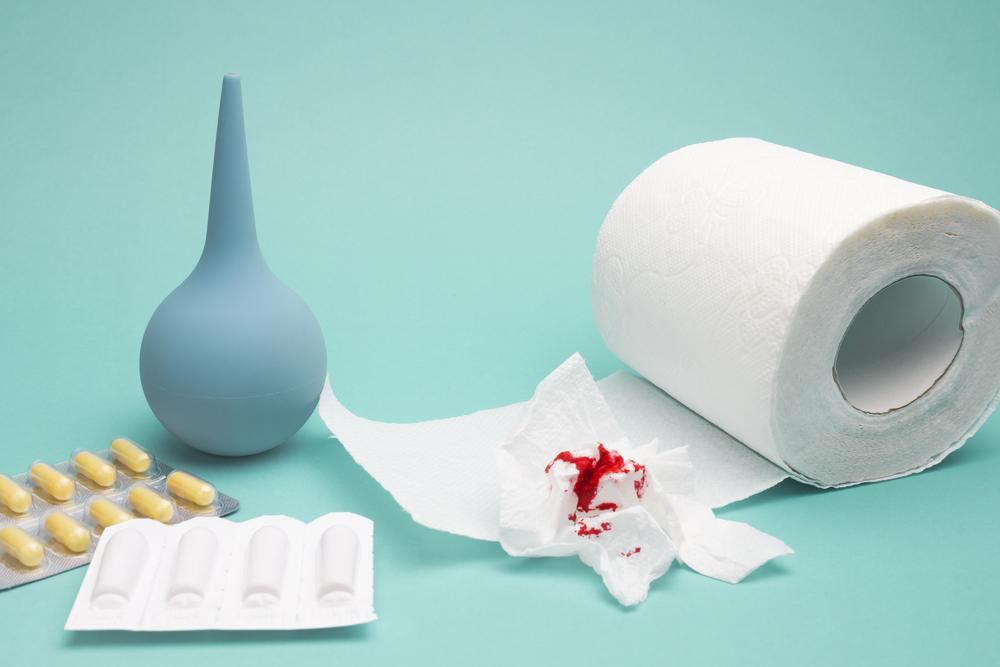 Pilihan Obat Ambeien dari Dokter yang Ampuh Redakan Gatal dan Nyeri