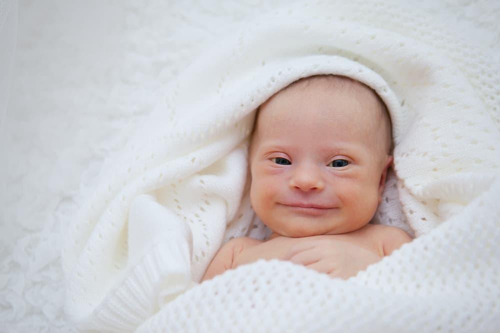 cara-mendeteksi-anak-down-syndrome