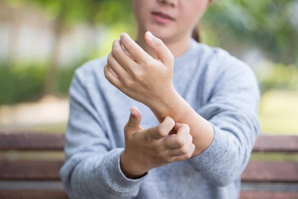 Alergi Keringat, Ketika Ruam Muncul Akibat Panas