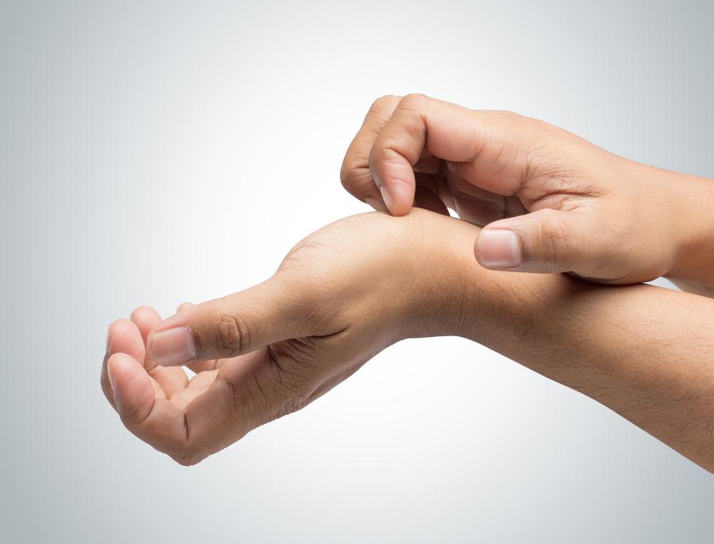 dishidrosis