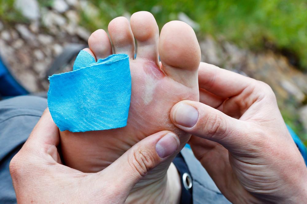 Gangren Diabetik, Kematian Jaringan Tubuh akibat Komplikasi Diabetes