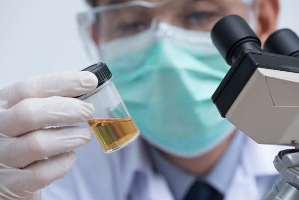 Mengulik Lebih Dalam Berbagai Fungsi dan Jenis Tes Urine (Urinalisis)