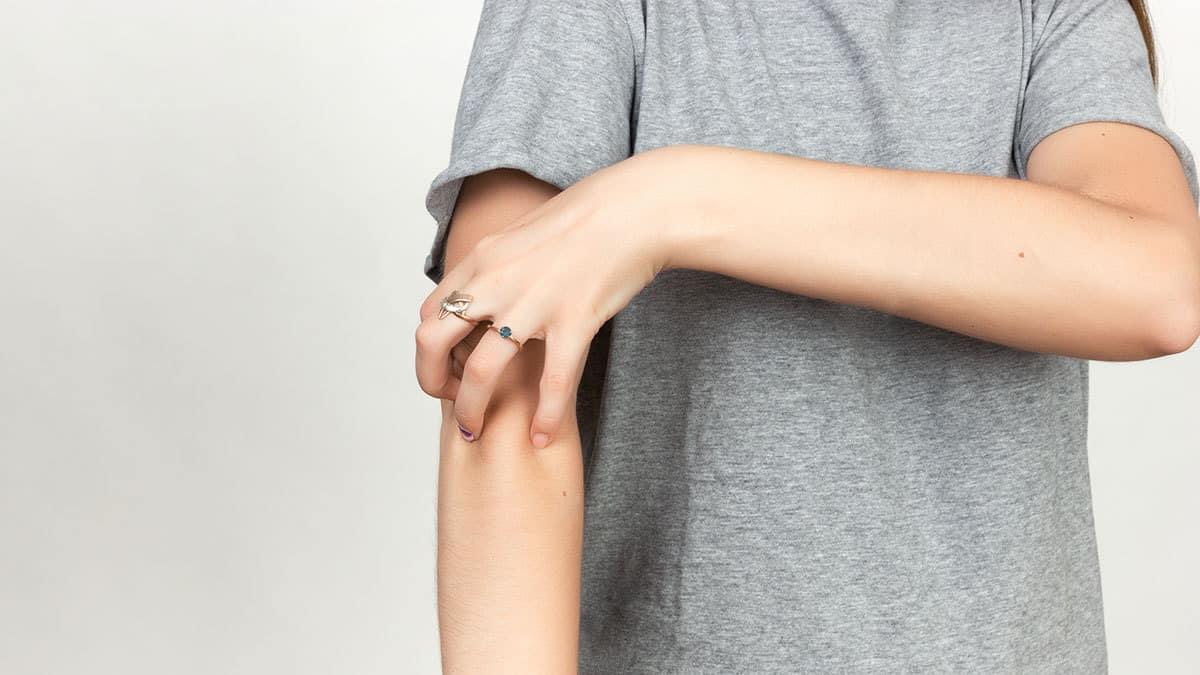 infeksi-jamur-pada-kulit