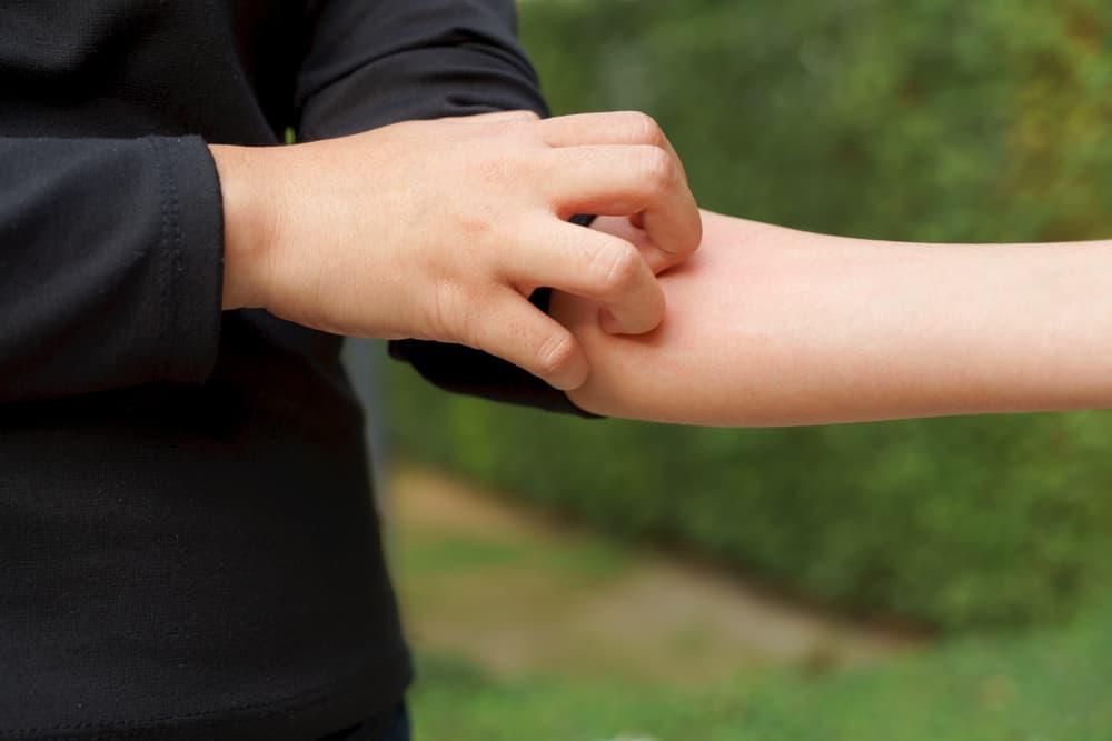 4 Langkah Mudah Mengatasi Kulit Gatal karena Diabetes