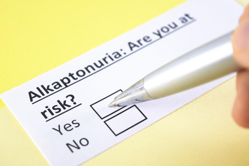 alkaptonuria