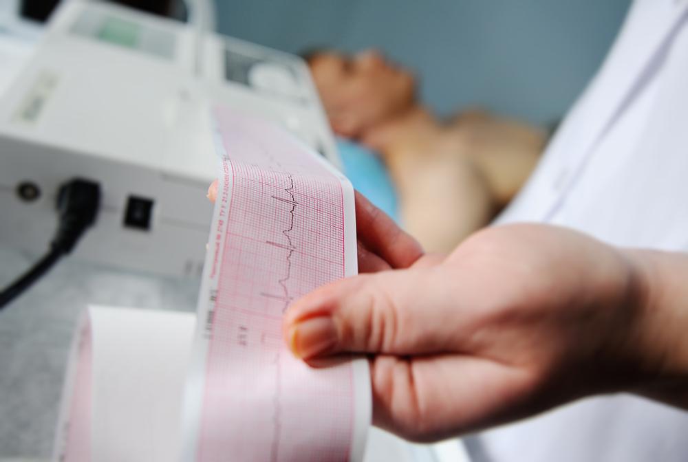 ekg-adalah-elektrokardiografi