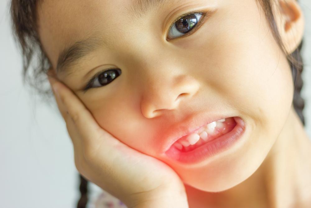 Tips Mengobati Sakit Gigi Anak Dengan Cara Alami