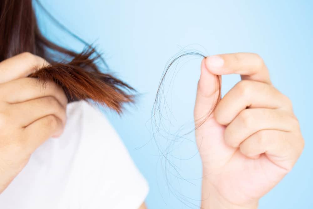 Ketombe Parah Bikin Rambut Rontok, Kok Bisa?
