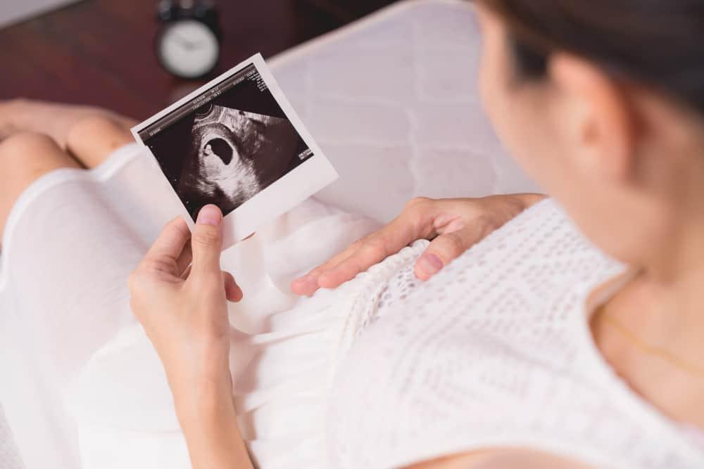 Trimester 2 Kehamilan: Perkembangan Janin, Perubahan Fisik, Sampai Perbedaan Gairah Seksual