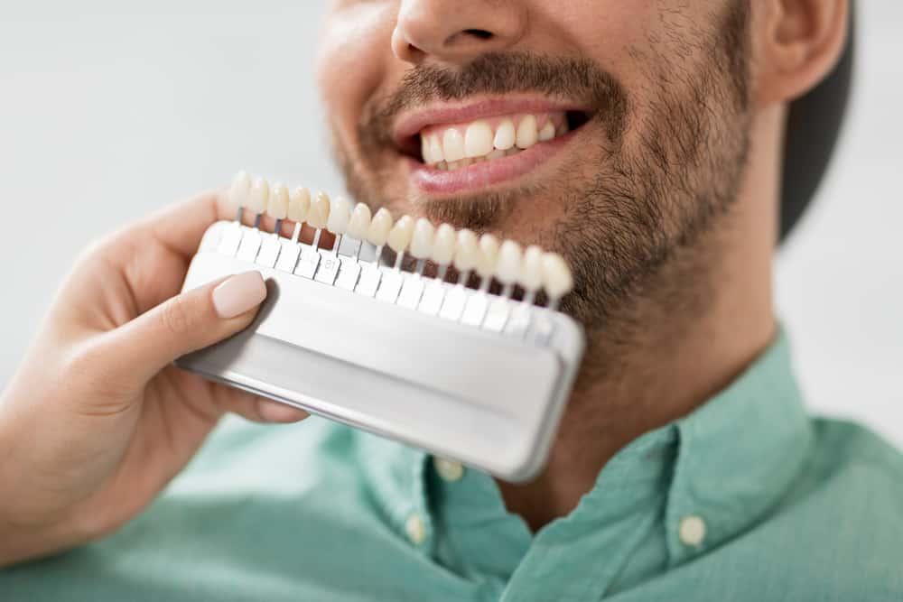 syarat-veneer-gigi