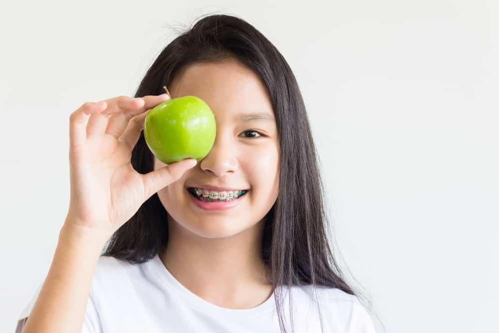 Baru Pasang Behel? Ini 3 Jenis Makanan yang Harus Anda Hindari