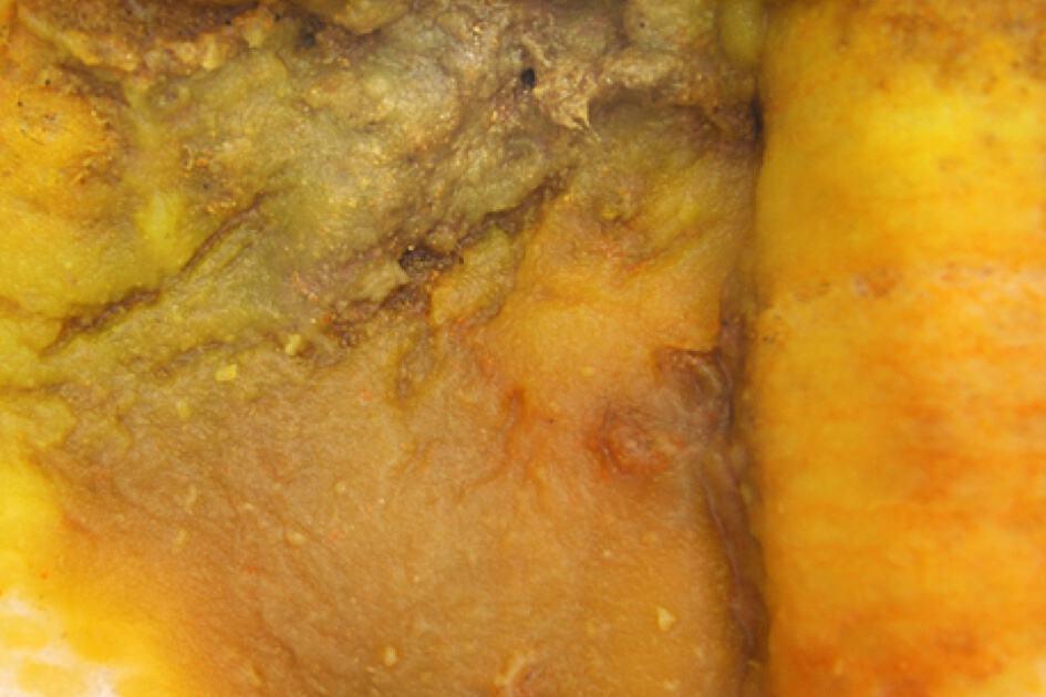 Kuning dan kasar